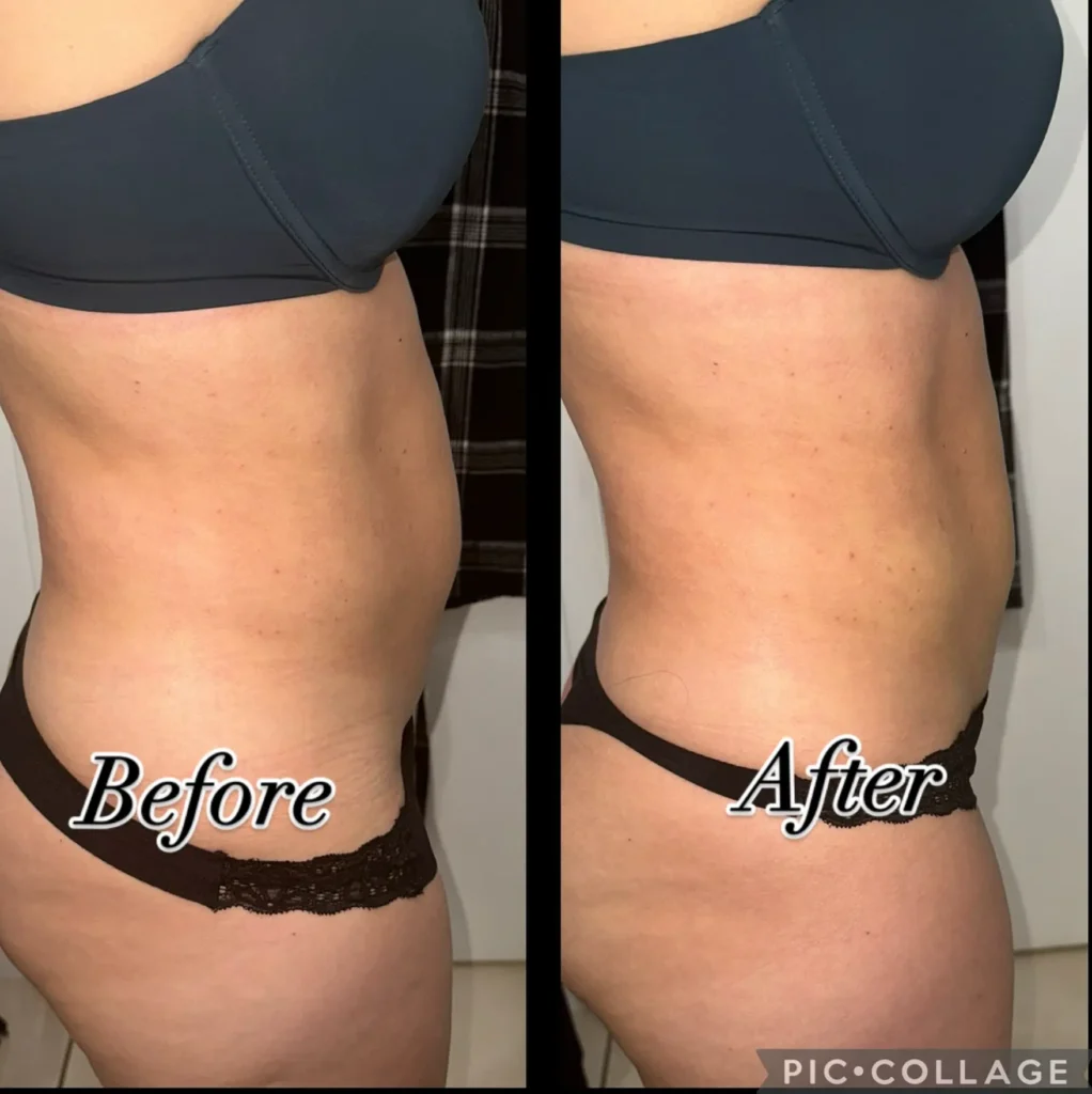 Transforma Tu Bienestar con BodyGlam by Mercy 38 109