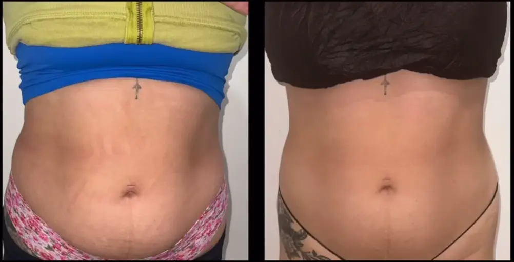 Transforma Tu Bienestar con BodyGlam by Mercy 25 12