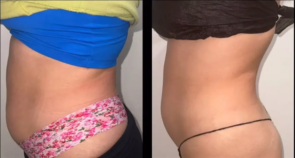 Transforma Tu Bienestar con BodyGlam by Mercy 26 12a