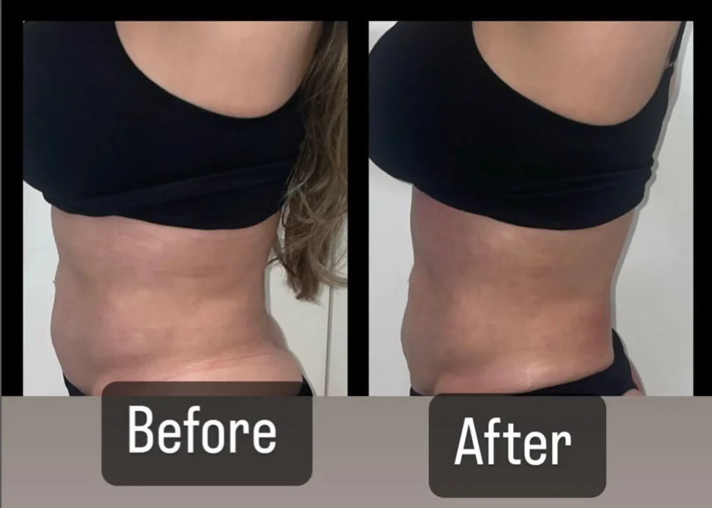 Transforma Tu Bienestar con BodyGlam by Mercy 45 145