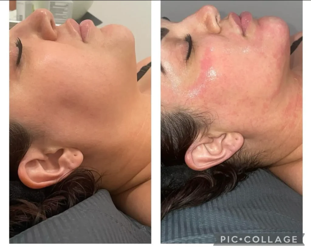 Transforma Tu Bienestar con BodyGlam by Mercy 46 148