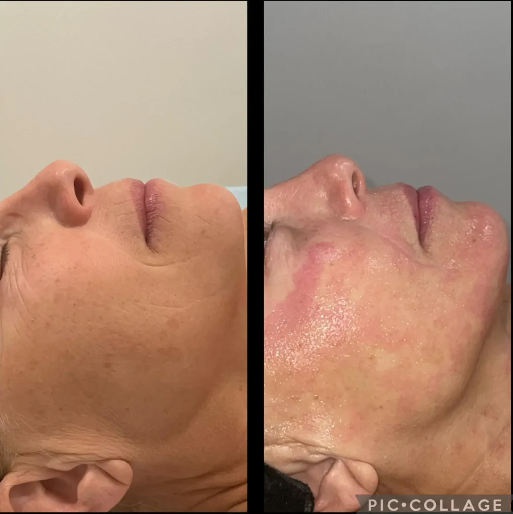 Transforma Tu Bienestar con BodyGlam by Mercy 47 157