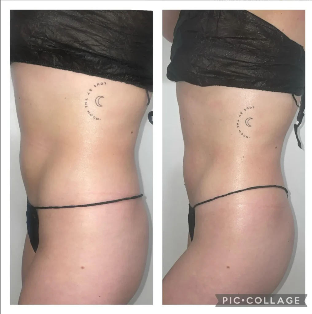 Transforma Tu Bienestar con BodyGlam by Mercy 49 165