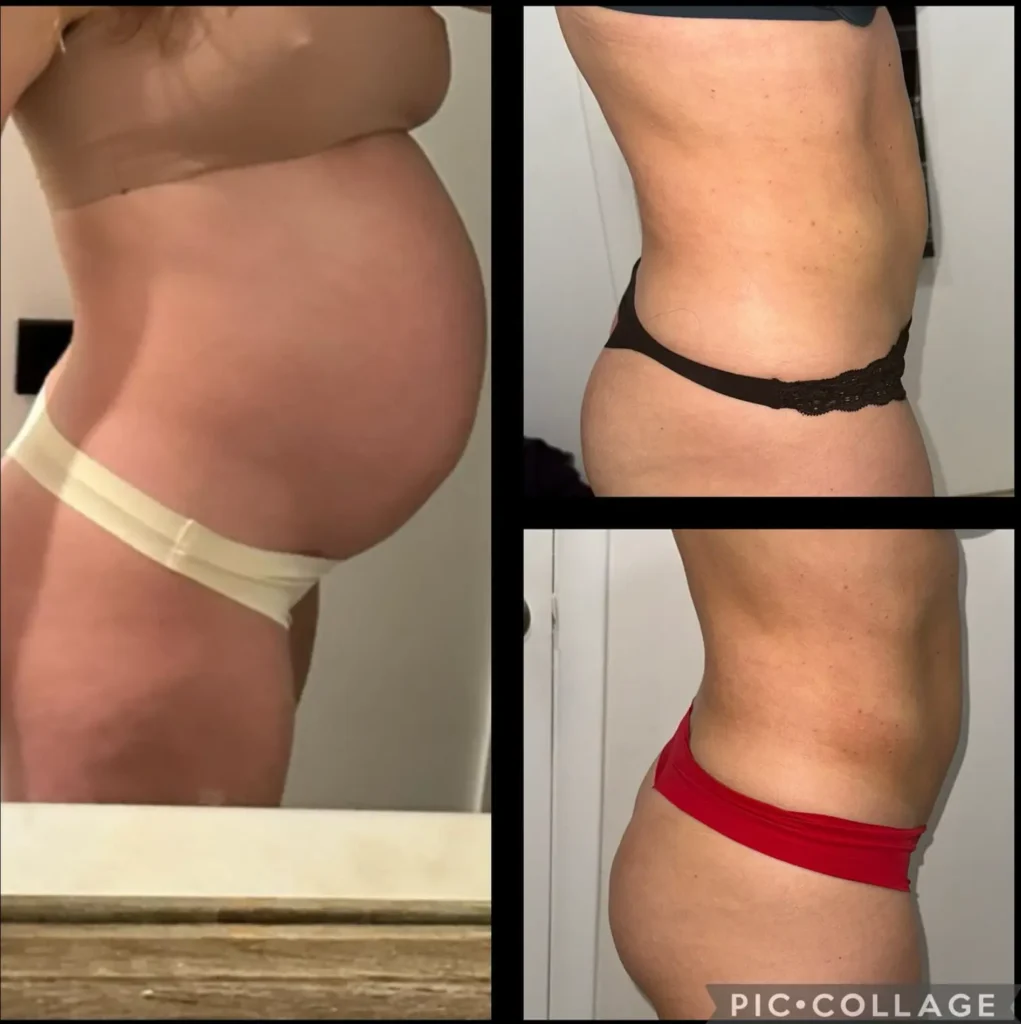 Transforma Tu Bienestar con BodyGlam by Mercy 27 19