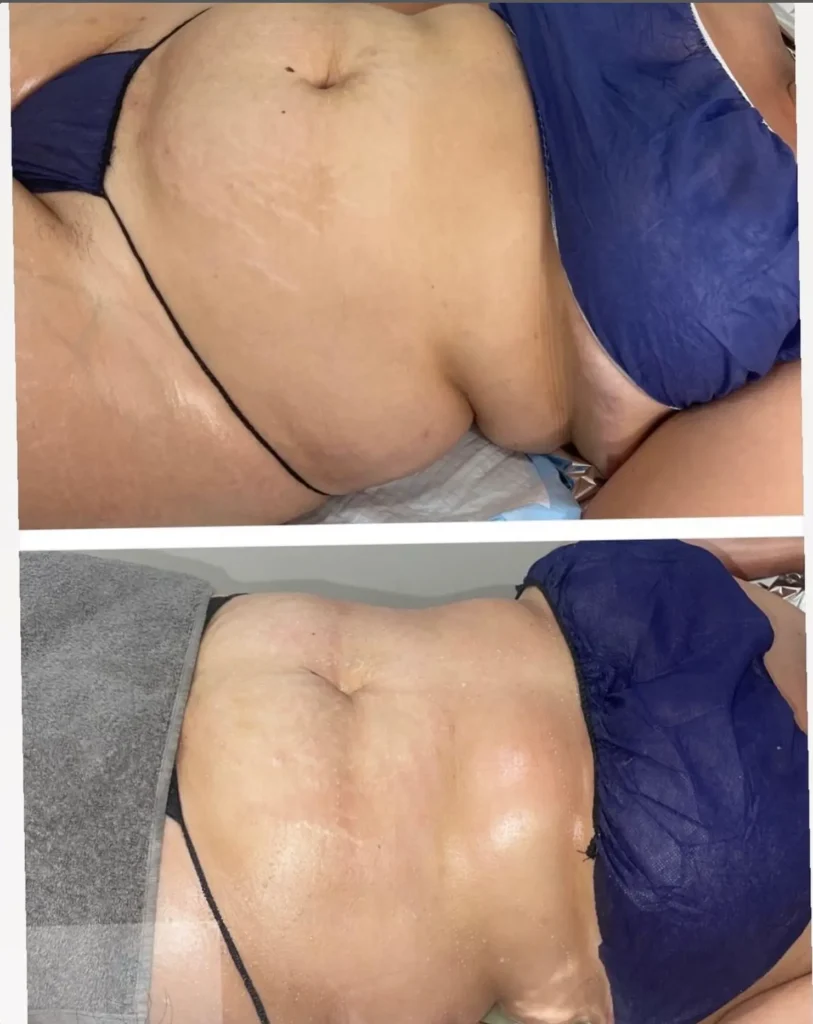 Transforma Tu Bienestar con BodyGlam by Mercy 28 22