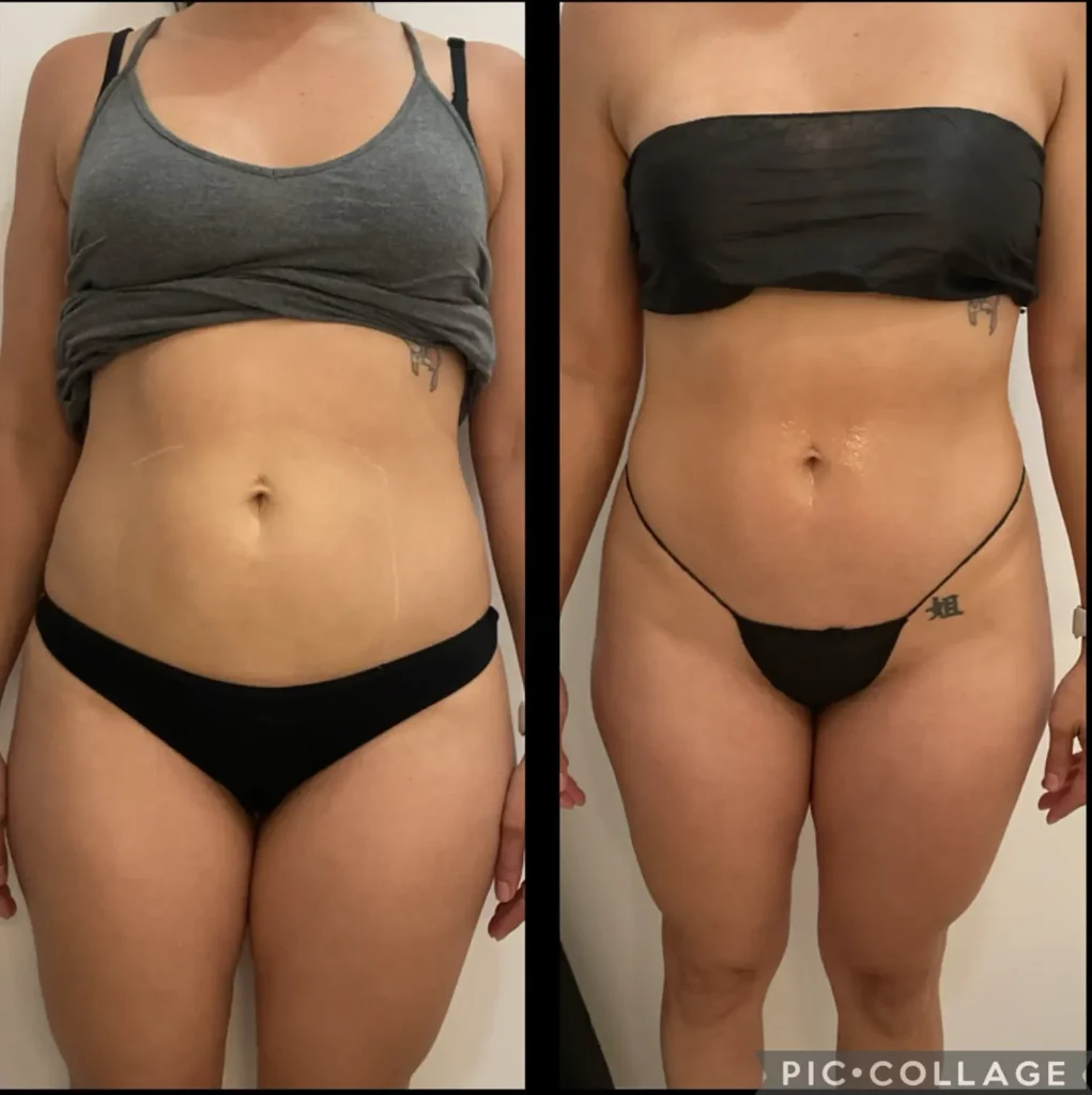 Transforma Tu Bienestar con BodyGlam by Mercy 29 25