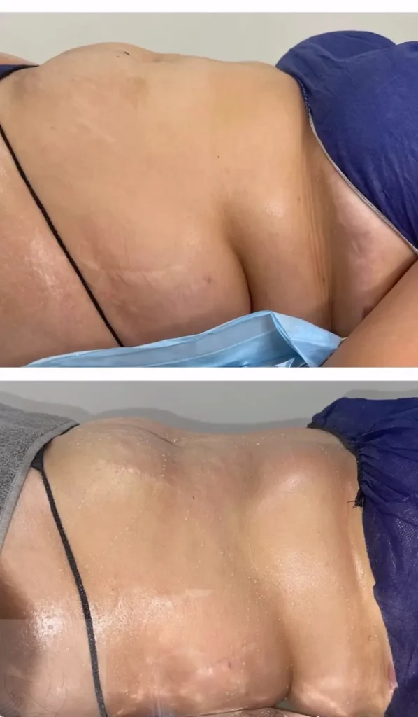 Transforma Tu Bienestar con BodyGlam by Mercy 30 28
