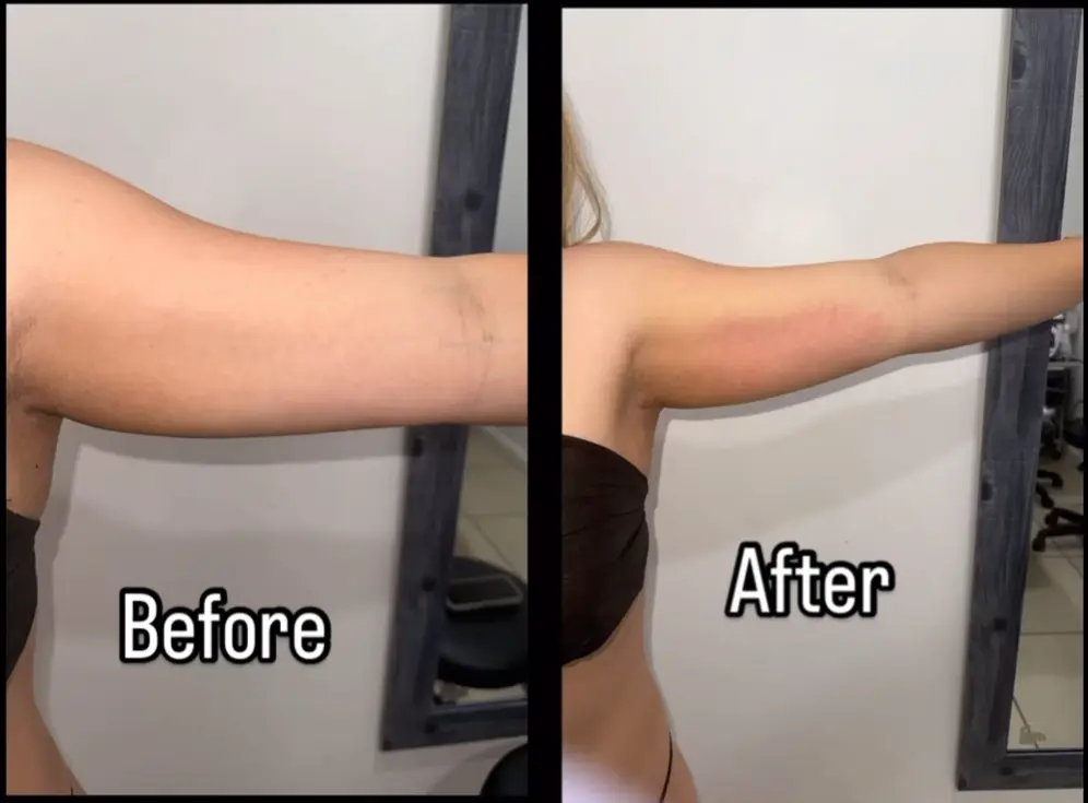 Transforma Tu Bienestar con BodyGlam by Mercy 31 29