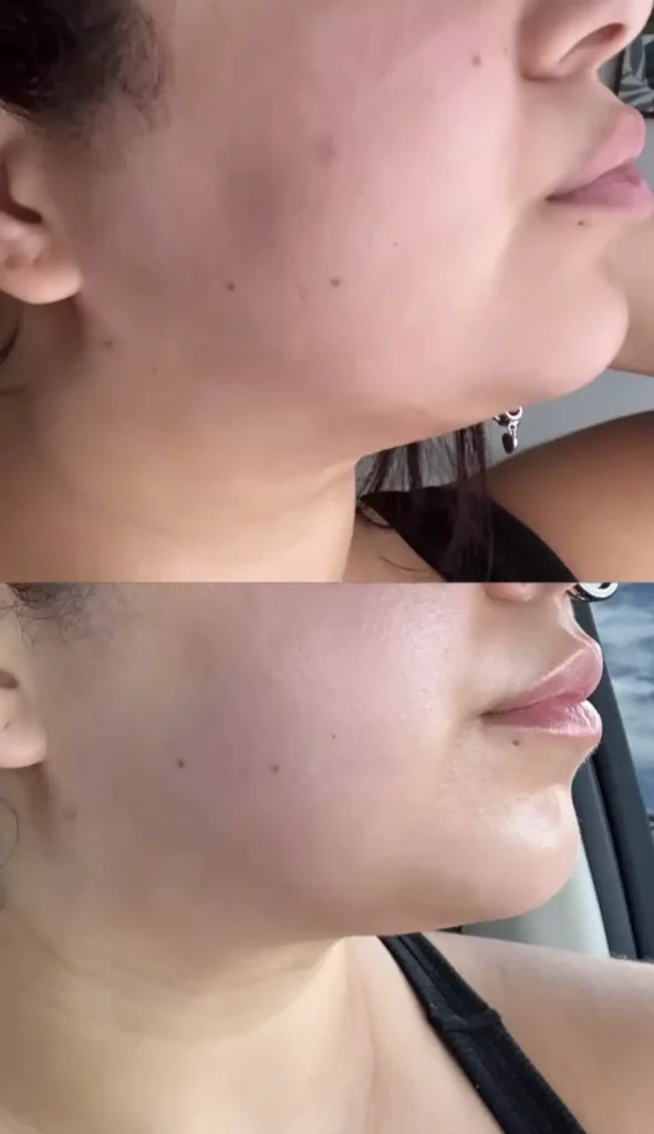 Transforma Tu Bienestar con BodyGlam by Mercy 33 43