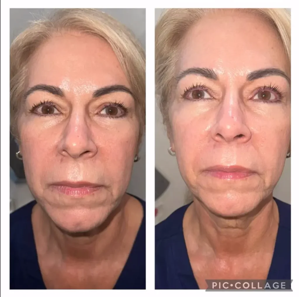 Transforma Tu Bienestar con BodyGlam by Mercy 34 49