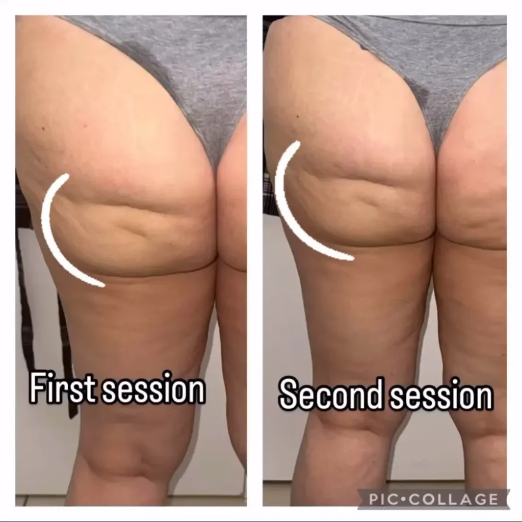Transforma Tu Bienestar con BodyGlam by Mercy 36 58