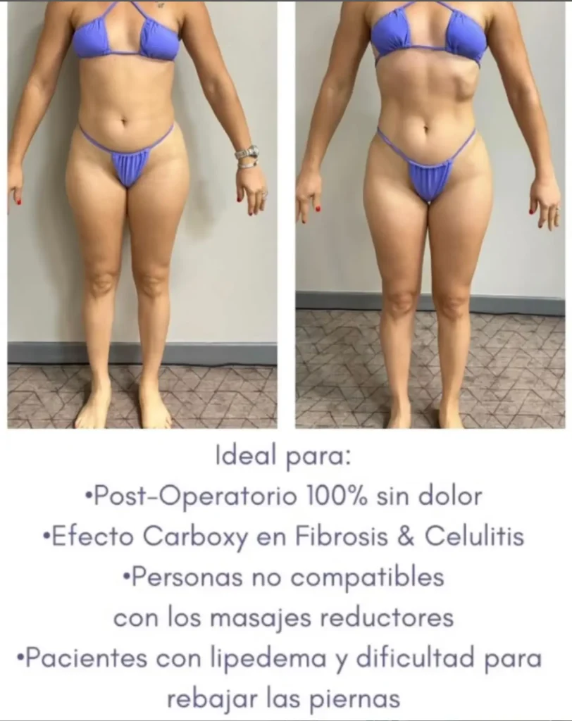 Transforma Tu Bienestar con BodyGlam by Mercy 12 82